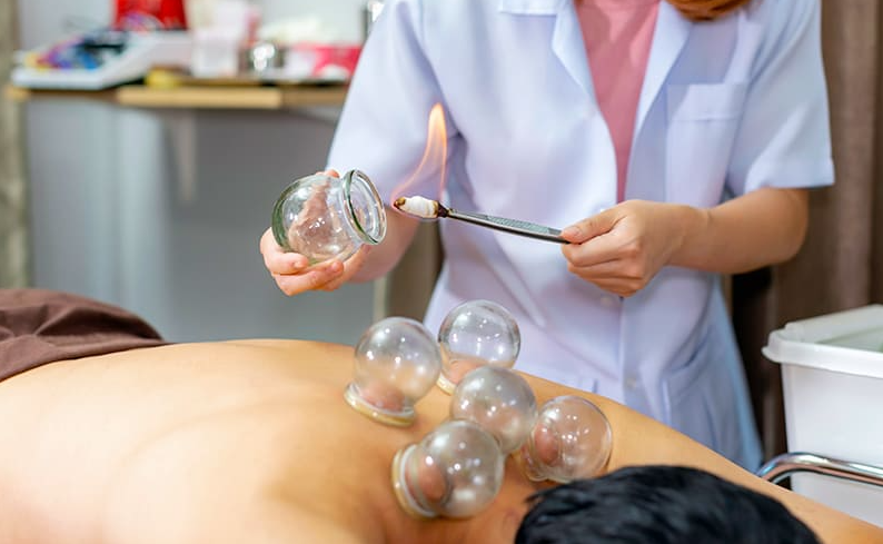 カッピングはアクティビティで疲れた体を癒やすのに最適です